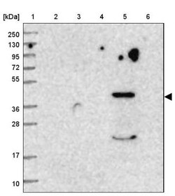 HPD Antibody, Novus Biologicals 0.1mL; Unlabeled:Antibodies, Polyclonal