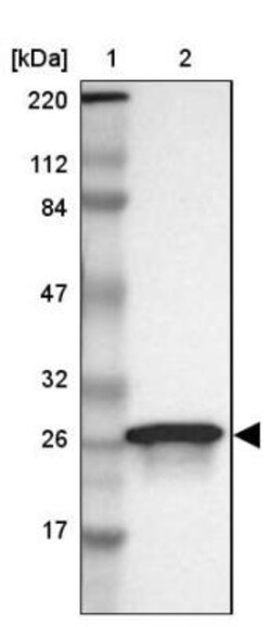 15-PGDH/HPGD Antibody, Novus Biologicals 0.1mL; Unlabeled:Antibodies, Polyclonal