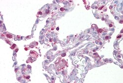 Hematopoietic Prostaglandin D Synthase/HPGDS Antibody, Novus Biologicals