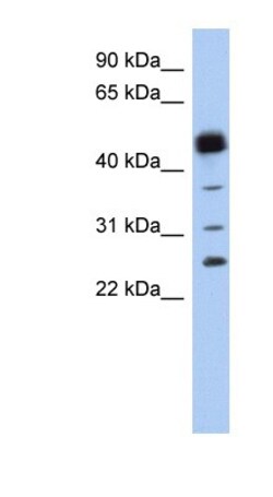 Hematopoietic Prostaglandin D Synthase/HPGDS Antibody, Novus Biologicals