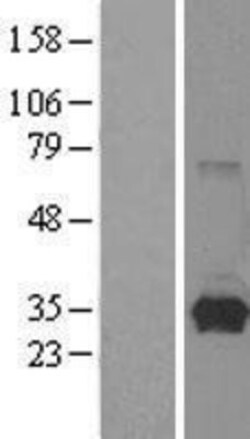 Novus Biologicals&trade;&nbsp;HPRT Overexpression Lysate