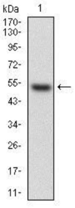 HPRT Antibody (5F11A7) - BSA Free, Novus Biologicals 0.1 mL | Buy Online | Novus Biologicals | Fisher Scientific