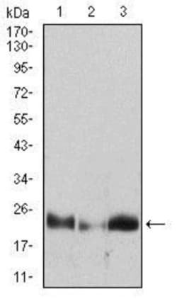 HPRT Antibody (5F11A7) - BSA Free, Novus Biologicals 0.1 mL | Buy Online | Novus Biologicals | Fisher Scientific