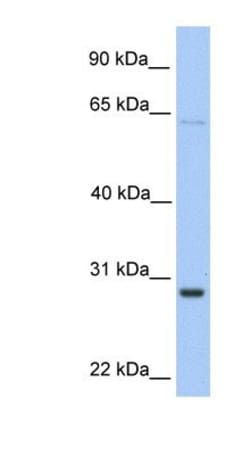 HPRT Antibody, Novus Biologicals:Antibodies:Primary Antibodies