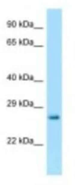 HPRT Antibody, Novus Biologicals 100&mu;L; Unlabeled:Antibodies, Polyclonal