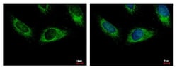 HPS3 Antibody, Novus Biologicals 0.1mL; Unlabeled:Antibodies, Polyclonal