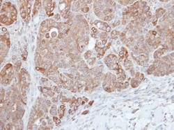 HPS3 Antibody, Novus Biologicals 0.1mL; Unlabeled:Antibodies, Polyclonal