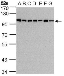 HPS3 Antibody, Novus Biologicals 0.1mL; Unlabeled:Antibodies, Polyclonal