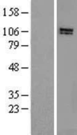 Novus Biologicals&trade;&nbsp;HPS3 Overexpression Lysate