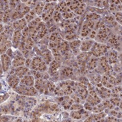 HPS3 Antibody, Novus Biologicals 25 &mu;L, Unconjugated:Antibodies, Polyclonal