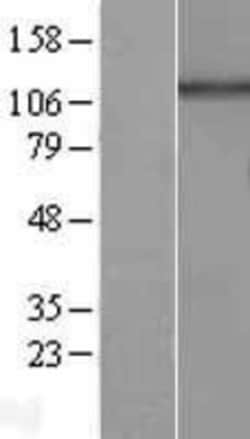 Novus Biologicals&trade;&nbsp;HPS5 Overexpression Lysate