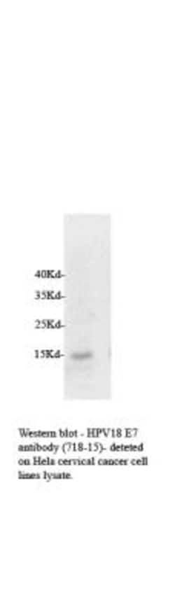 HPV18 E7 Antibody (718-15), DyLight 550, Novus Biologicals:Antibodies:Primary