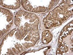 HRAS Antibody, Novus Biologicals 0.1mL:Antibodies, Polyclonal
