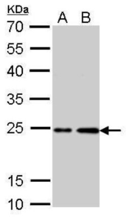 HRAS Antibody, Novus Biologicals 0.1mL:Antibodies, Polyclonal