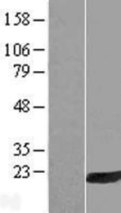 Novus Biologicals&trade;&nbsp;PLA2G16/HRASLS3 Overexpression Lysate
