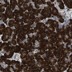HRD1 Antibody, Novus Biologicals 25 &mu;L; Unlabeled:Antibodies, Polyclonal