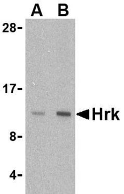 Hrk Antibody - BSA Free, Novus Biologicals 0.025 mg | Buy Online | Novus Biologicals | Fisher Scientific