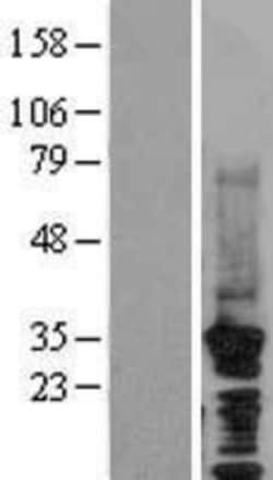 Novus Biologicals™ CDC73/HRPT2 Overexpression Lysate