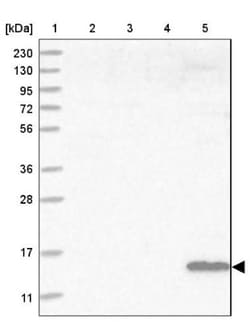 HRSP12 Antibody, Novus Biologicals 25 &mu;L; Unlabeled:Antibodies, Polyclonal