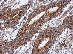 HS3ST2 Antibody, Novus Biologicals 0.1mL; Unlabeled:Antibodies, Polyclonal