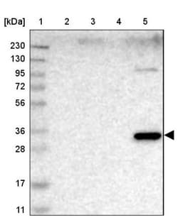 HS3ST2 Antibody, Novus Biologicals 25 &mu;L | Buy Online | Novus Biologicals | Fisher Scientific