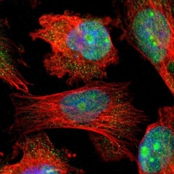 HS3ST2 Antibody, Novus Biologicals 25 &mu;L | Buy Online | Novus Biologicals | Fisher Scientific