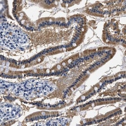 HS3ST2 Antibody, Novus Biologicals 25 &mu;L | Buy Online | Novus Biologicals | Fisher Scientific