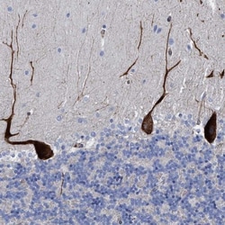 HS3ST5 Antibody, Novus Biologicals:Antibodies:Primary Antibodies
