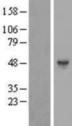 Novus Biologicals&trade;&nbsp;Heparan Sulfate 6-O-Sulfotransferase 1/HS6ST1 Overexpression Lysate