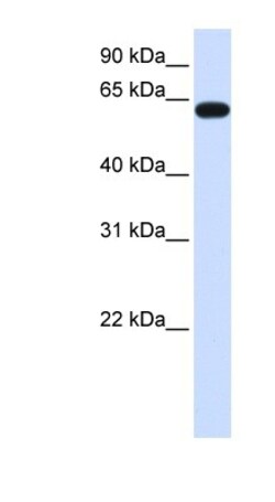 Heparan Sulfate 6-O-Sulfotransferase 3/HS6ST3 Antibody, Novus Biologicals