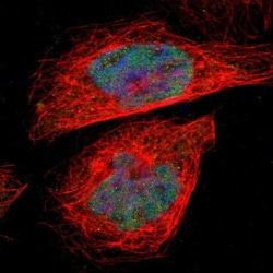 HS747E2A Antibody, Novus Biologicals 25 &mu;L; Unlabeled:Antibodies, Polyclonal