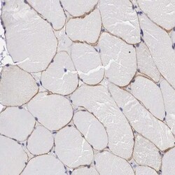 HS747E2A Antibody, Novus Biologicals 25 &mu;L; Unlabeled:Antibodies, Polyclonal