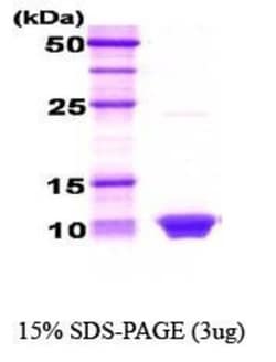 Novus Biologicals&trade;&nbsp;Recombinant Human HSBP1 Protein