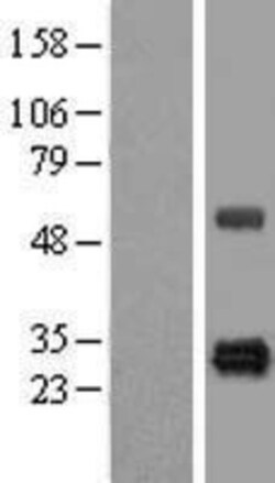 Novus Biologicals&trade;&nbsp;HSCB Overexpression Lysate