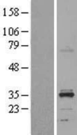 Novus Biologicals&trade;&nbsp;HSD11B1L Overexpression Lysate