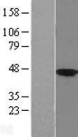 Novus Biologicals&trade;&nbsp;HSD11B2 Overexpression Lysate