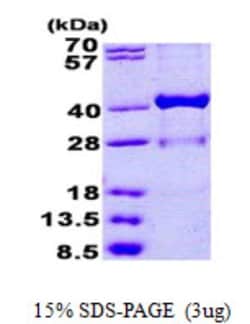 Novus Biologicals&trade;&nbsp;Recombinant Human 17 beta-HSD1/HSD17B1 His Protein