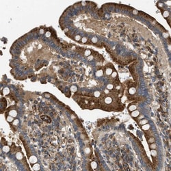 HSD17B12 Antibody, Novus Biologicals:Antibodies:Primary Antibodies