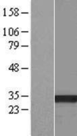 Novus Biologicals™ HSD17B13 Overexpression Lysate