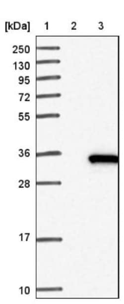 17 beta-HSD14/HSD17B14 Antibody, Novus Biologicals 0.1mL; Unlabeled:Antibodies,
