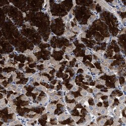 17 beta-HSD14/HSD17B14 Antibody, Novus Biologicals 0.1mL; Unlabeled:Antibodies,
