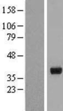 Novus Biologicals&trade;&nbsp;HSD17B2 Overexpression Lysate