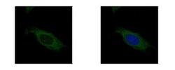 HSD17B3 Antibody, Novus Biologicals 0.1mL; Unlabeled:Antibodies, Polyclonal