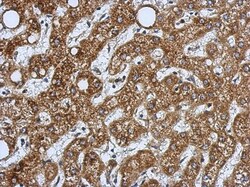 HSD17B3 Antibody, Novus Biologicals 0.1mL; Unlabeled:Antibodies, Polyclonal