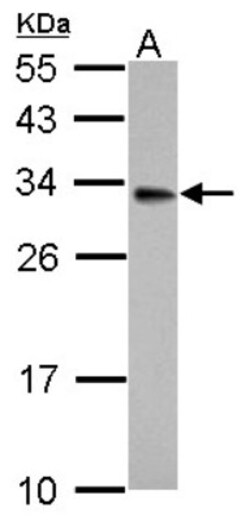 HSD17B3 Antibody, Novus Biologicals 0.1mL; Unlabeled:Antibodies, Polyclonal