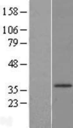 Novus Biologicals&trade;&nbsp;HSD17B3 Overexpression Lysate