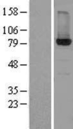 Novus Biologicals&trade;&nbsp;HSD17B4 Overexpression Lysate