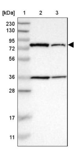 HSD17B4 Antibody, Novus Biologicals 0.1mL; Unlabeled:Antibodies, Polyclonal
