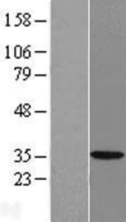 Novus Biologicals&trade;&nbsp;HSD17B7 Overexpression Lysate