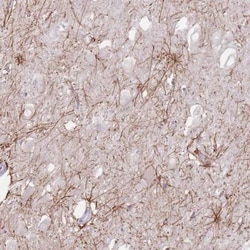 HSD5 Antibody, Novus Biologicals:Antibodies:Primary Antibodies